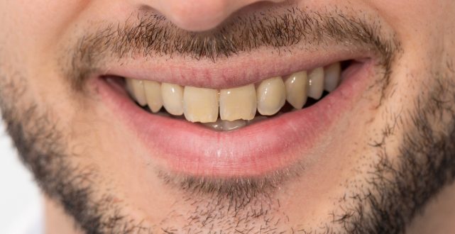 Smiling patient